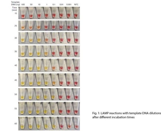 *LAMP Yöntemi ile İnsan Apolipoprotein L1 Geninin İzotermal Amplifikasyonu* 